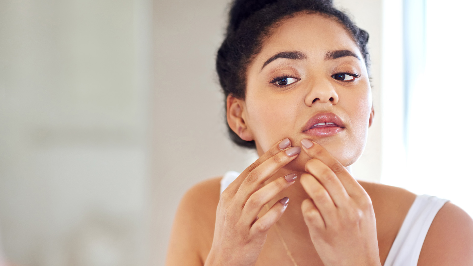 Monsoon Skincare - Dermatologist's Guide to combat Monsoon Acne | BIODERMA