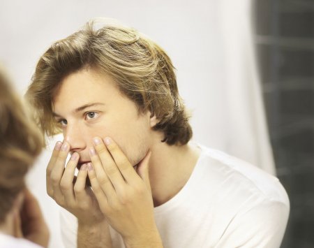 teenager with acne